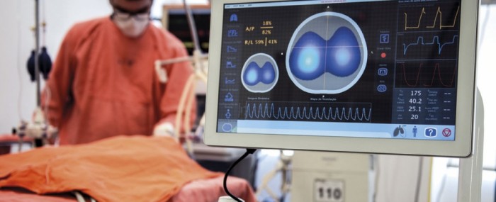 Tecnologia otimiza o uso de ventiladores pulmonares e de leitos em UTI